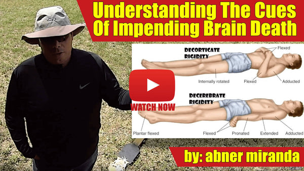 Understanding the Cues of Impending Brain Death